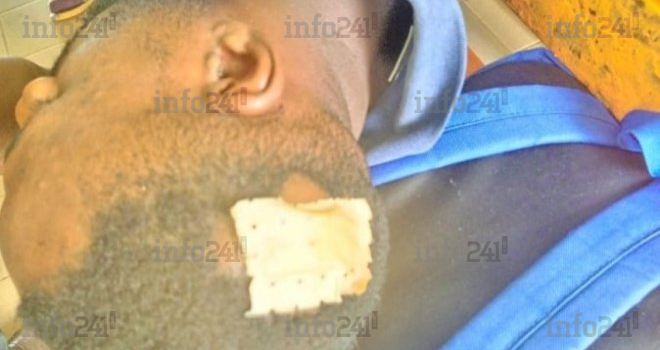 Oyem&nbsp;: Une rixe entre 3 jeunes gabonais pour de la bière volée finit à l’hôpital et à la DGR&nbsp;!