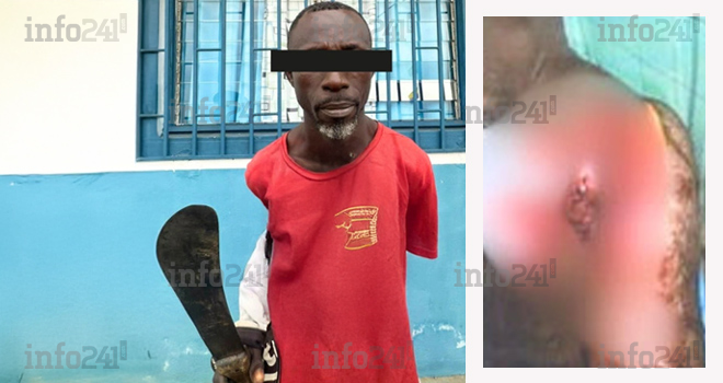 Nkoltang&nbsp;: Un ghanéen cocufié tente de trancher le cou de son rival gabonais à la machette